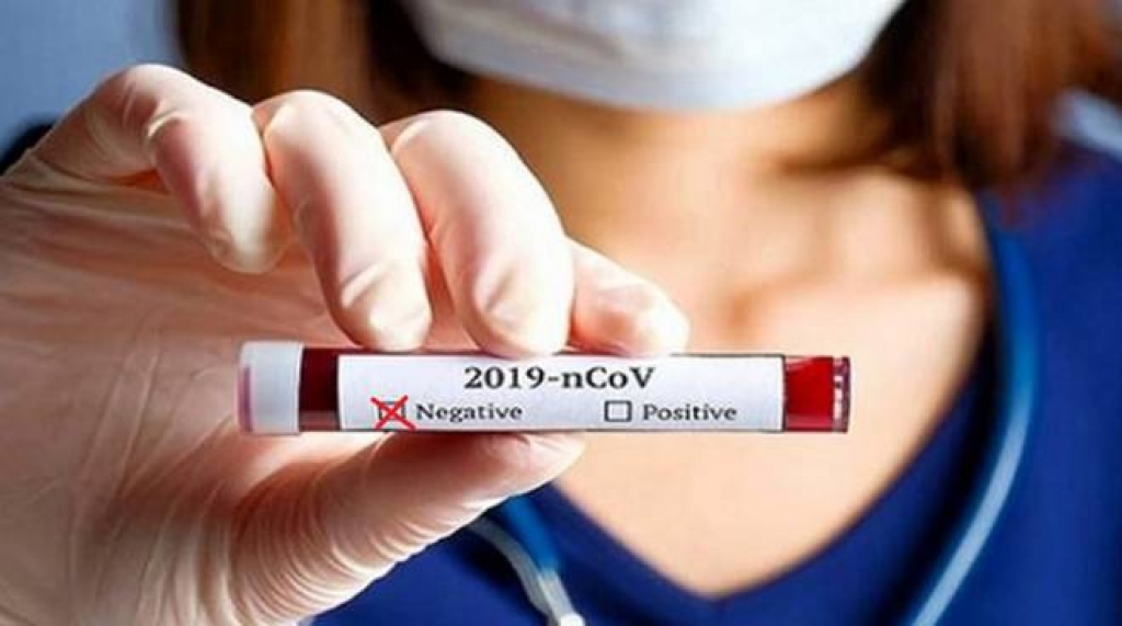 negativo coronavirus