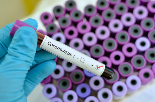 corornavirus-sei-tamponi-positivi-provincia-caserta
