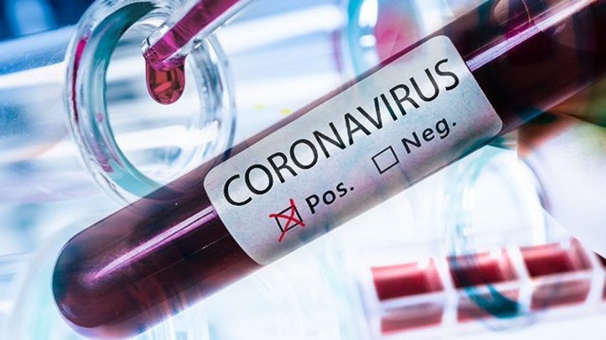 CORONAVIRUS-2